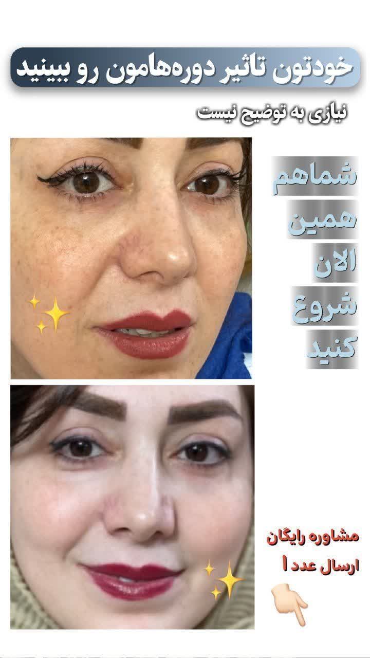 کرم ضد لک لاکچری کوین ،فرانسه