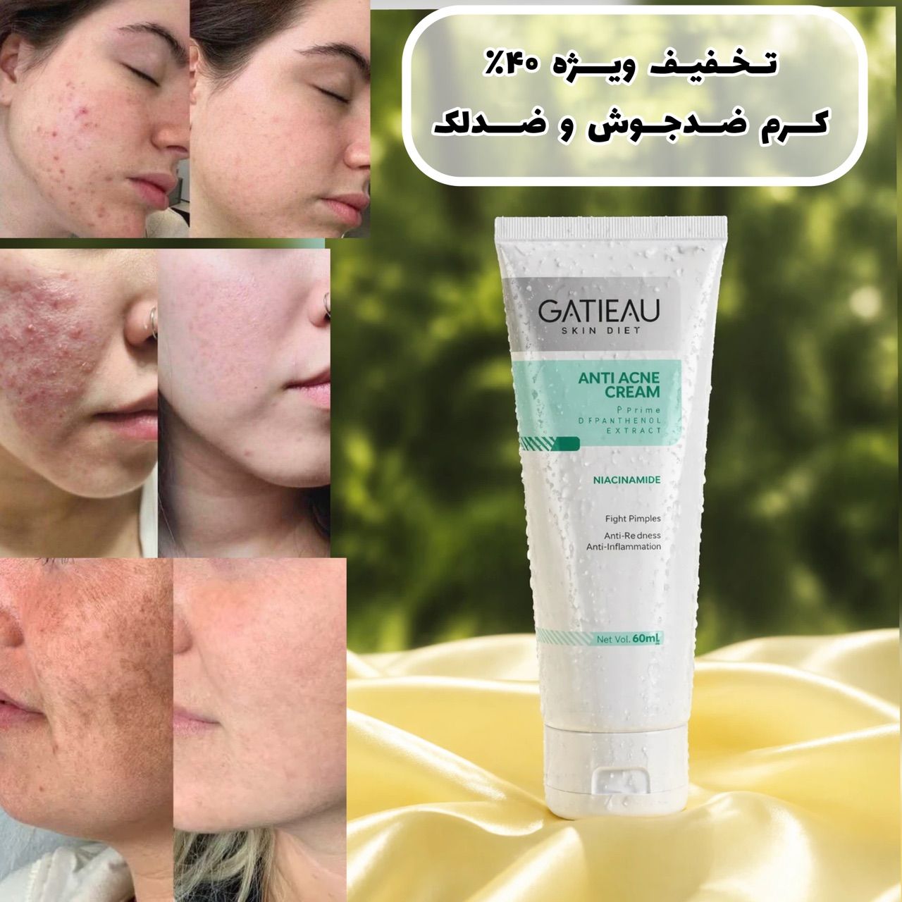 کرم ضد جوش واکنه،گاتیو،اصل